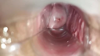 turning-point inside make an issue of vagina close-up